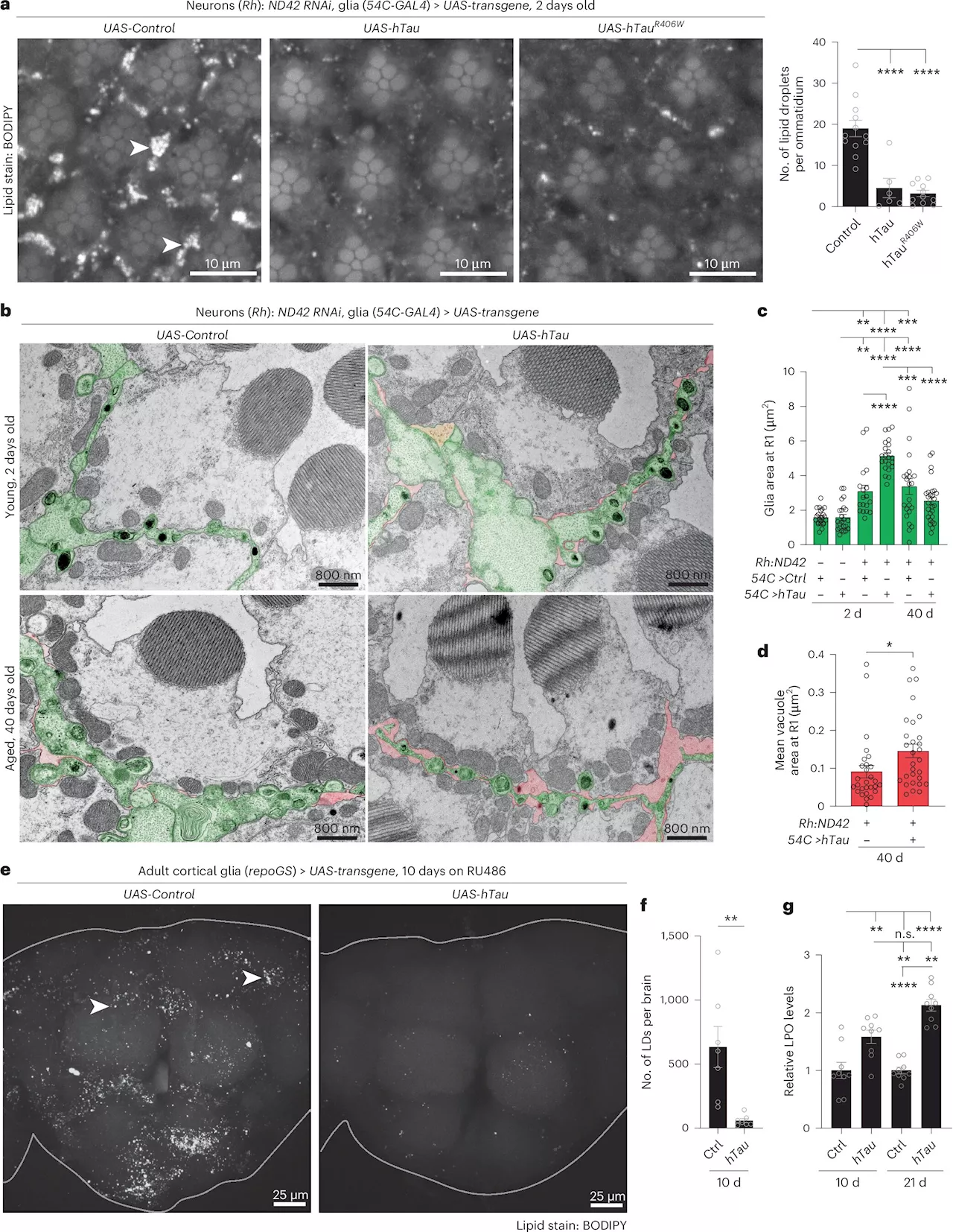 Not just a 'bad guy': Researchers discover neuroprotective function of Tau protein