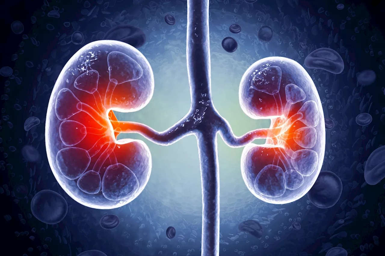 Acute kidney injury doubles dementia risk, study finds