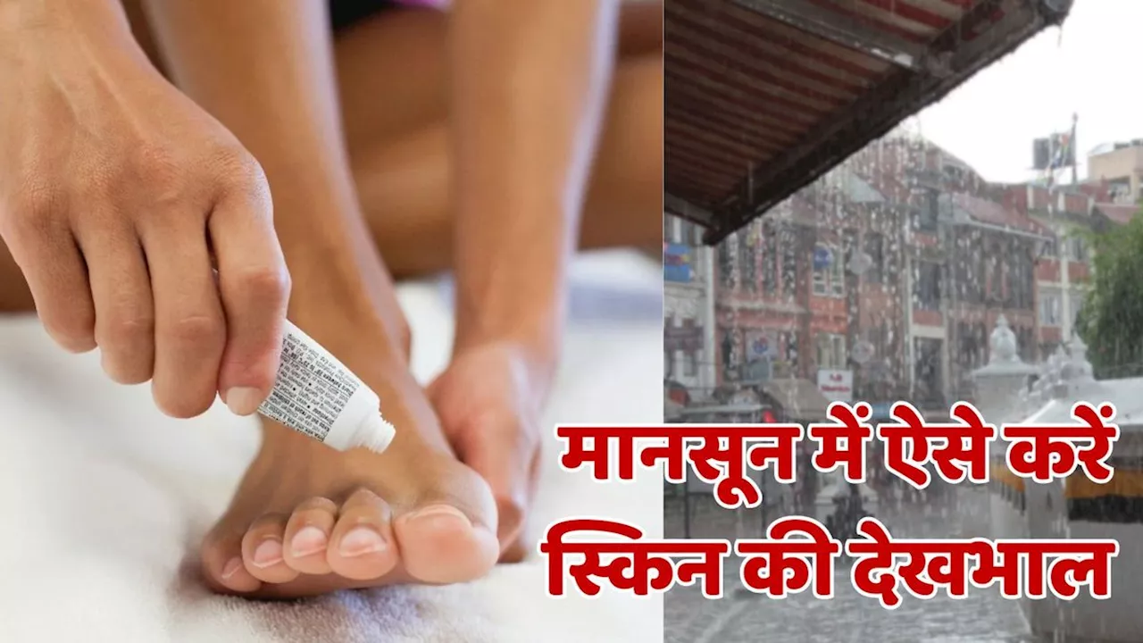 Monsoon Skincare Tips:मानसून में स्किन इंफेक्शन से बचने के लिए अपनाएं ये 5 घरेलू नुस्खे