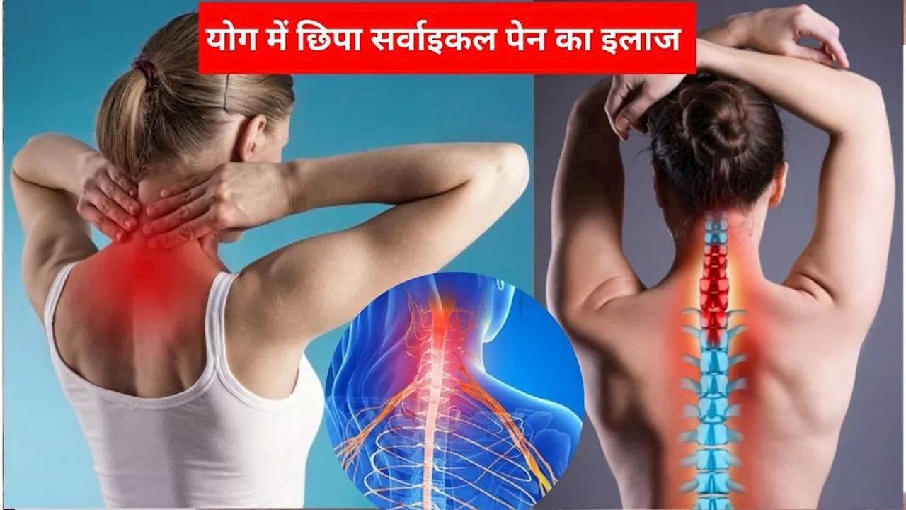 Yoga For Cervical Pain: डॉक्टर की दवाईयां नहीं कर रहीं काम, योग से मिलेगा सर्वाइकल पेन में आराम