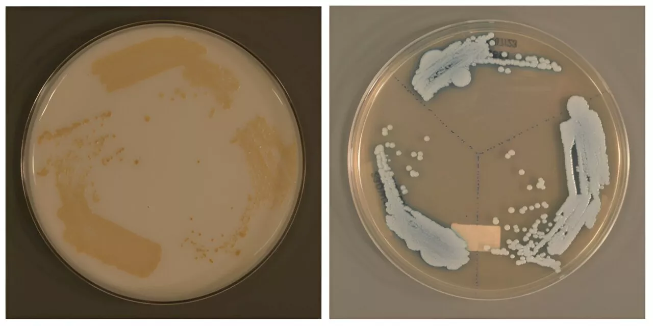 Researchers discover new Candida auris—a possible global public health threat