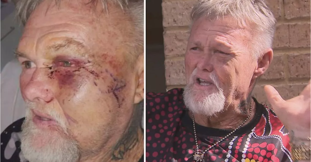 Perth grandfather needed metal plates in face after alleged bashing and $50,000 gold robbery