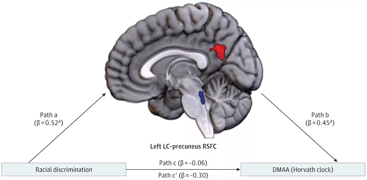 Racism and discrimination lead to faster aging through brain network changes, new study finds