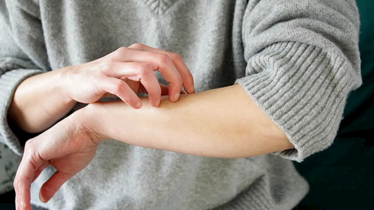 Nemolizumab Effective in Atopic Dermatitis