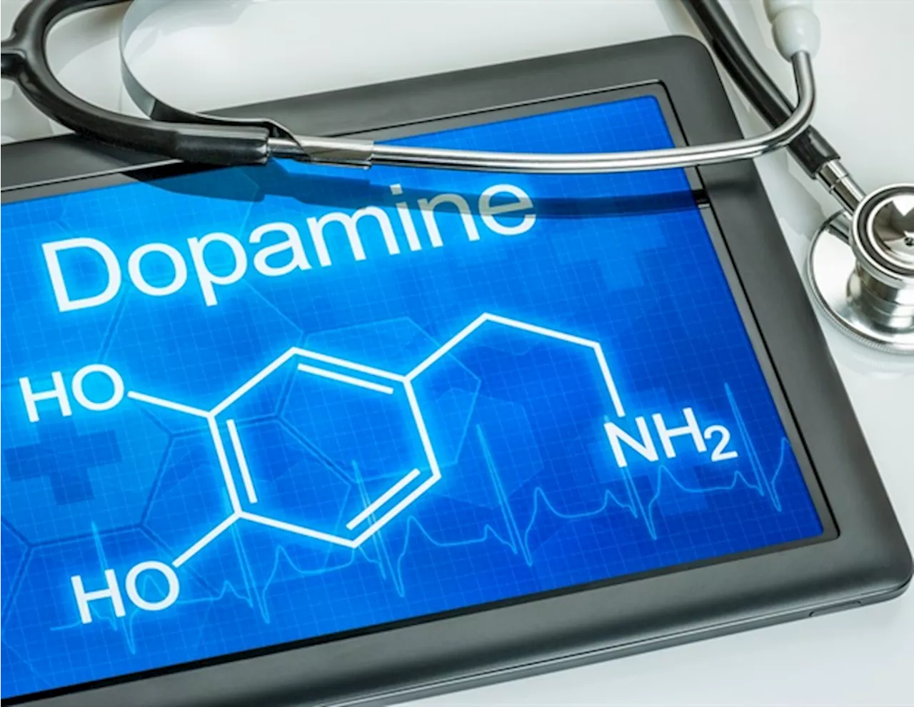 Dopamine treatment can reduce Alzheimer's plaques and improve memory