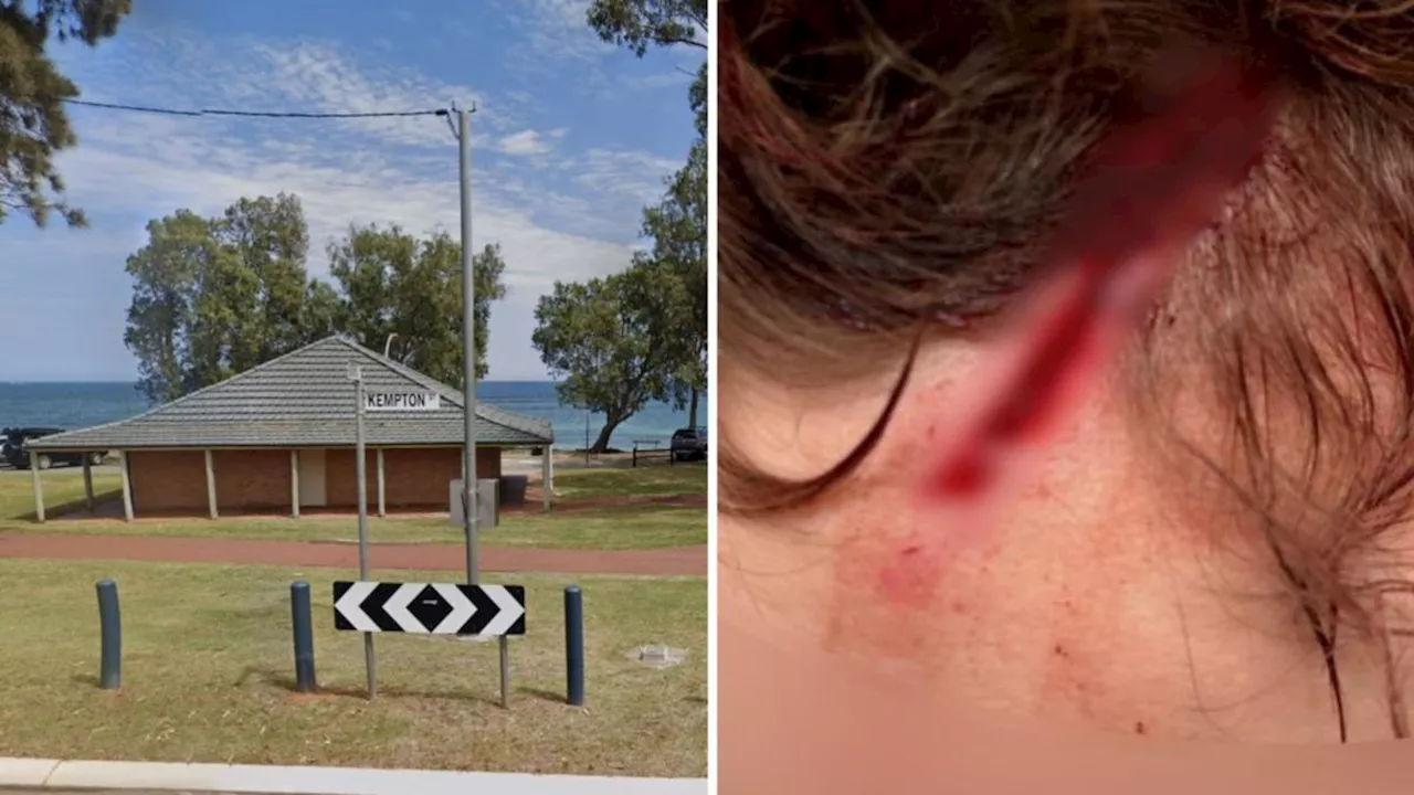 Geraldton detectives investigate garden tool attack on German backpacker inside toilet block