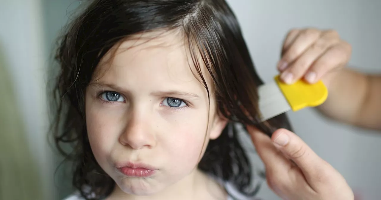 Get rid of nits 'first time' with 'go-to' treatment all families should have