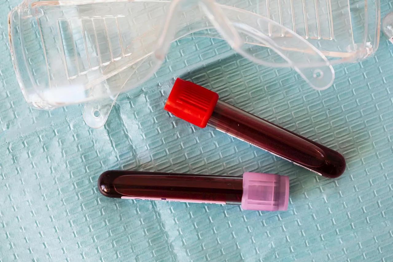 New evidence casts doubt on a much-hyped blood test for early cancer detection