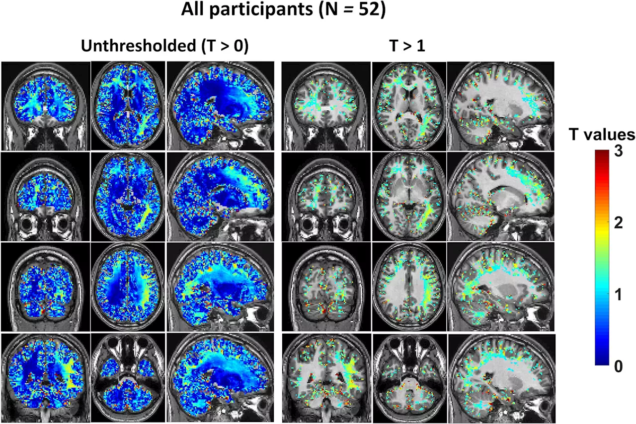 Shedding light on alcohol's impact on brain activity in social drinkers