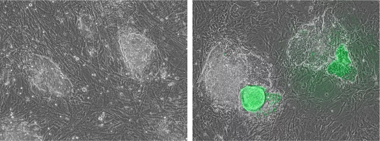 Study finds viral defense protein speeds up female stem cell production