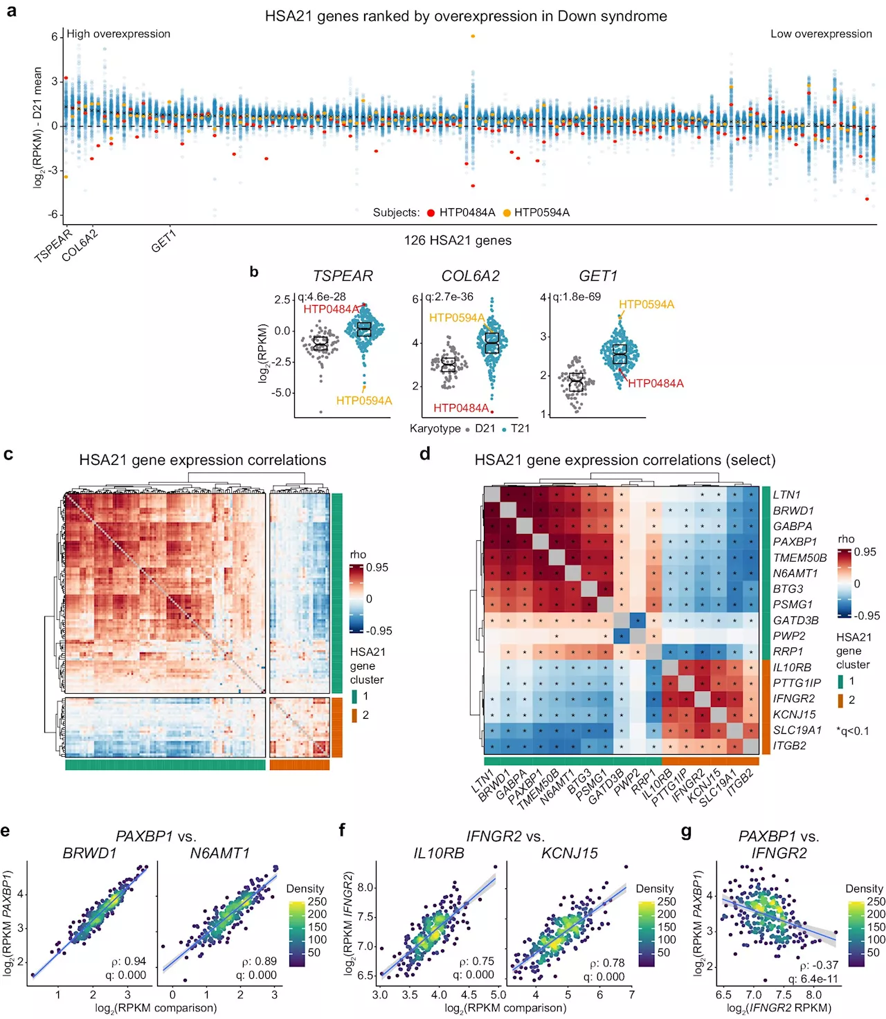 Study reveals molecular subtypes of Down syndrome, offering insights for personalized medicine approaches