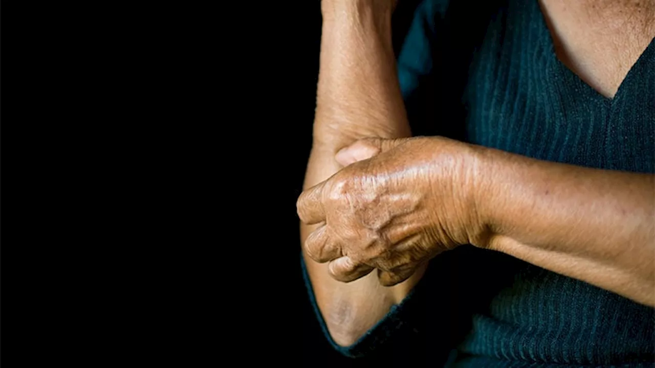 Chronic Itch in Older Adults: Workup and Management Advice