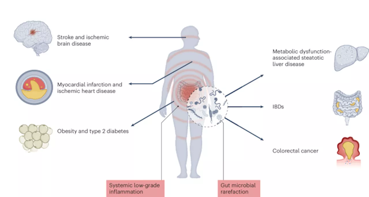 Western diets and chronic diseases