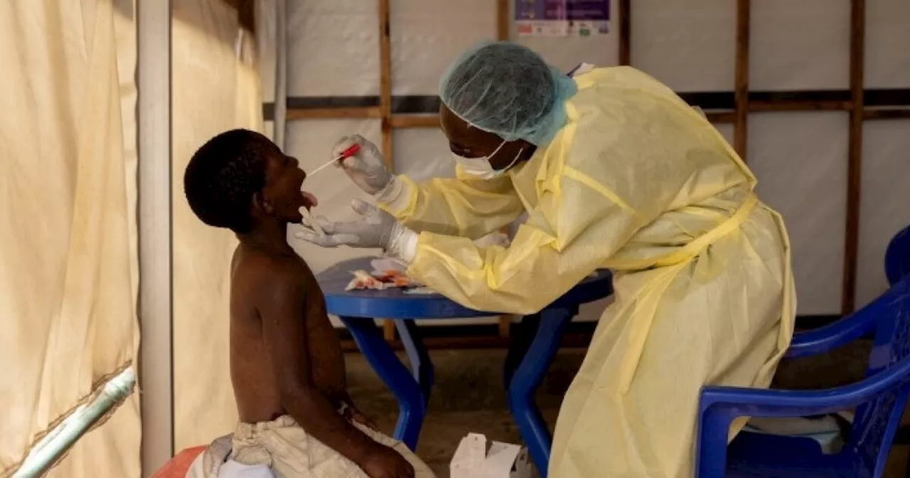 Alarmed by mpox surge, Africa CDC is poised to declare a 'continental emergency'