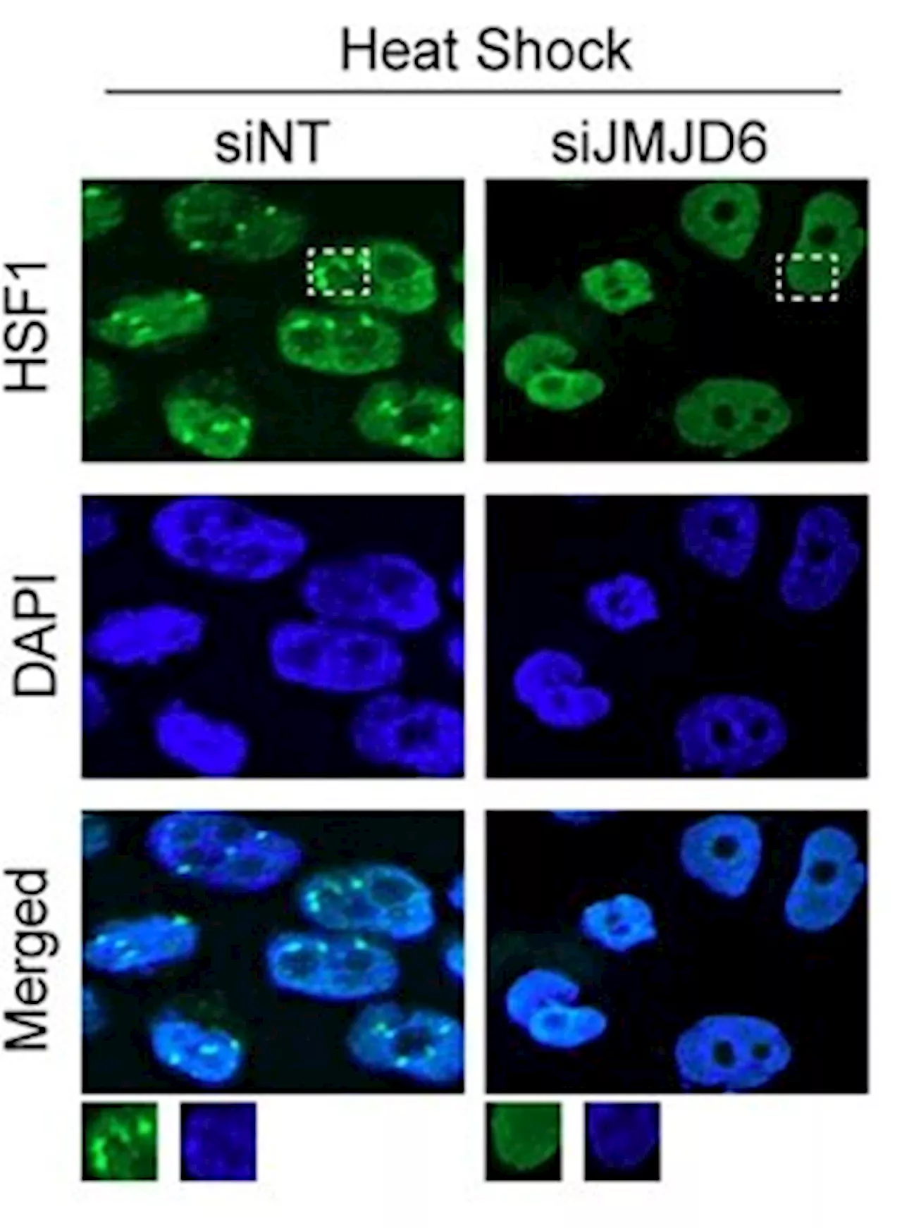 Feedback loop promotes cancer cells' adaption to molecular stress