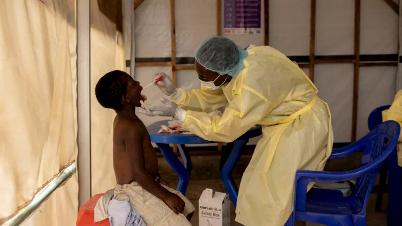 Alarmed by mpox surge, Africa CDC is poised to declare a 'continental emergency'