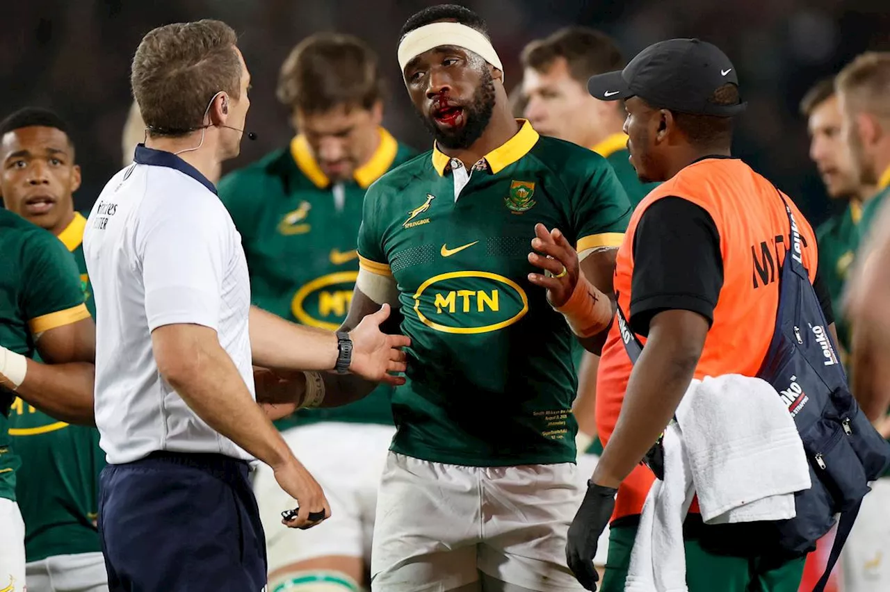 Rugby Championship : crainte de fracture pour le capitaine sud-africain Kolisi