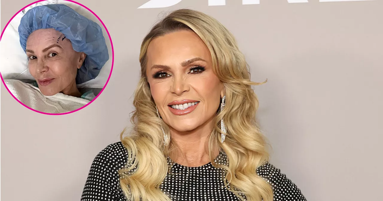 The Real Housewives of Orange County’s Tamra Judge Gets a Brow Lift