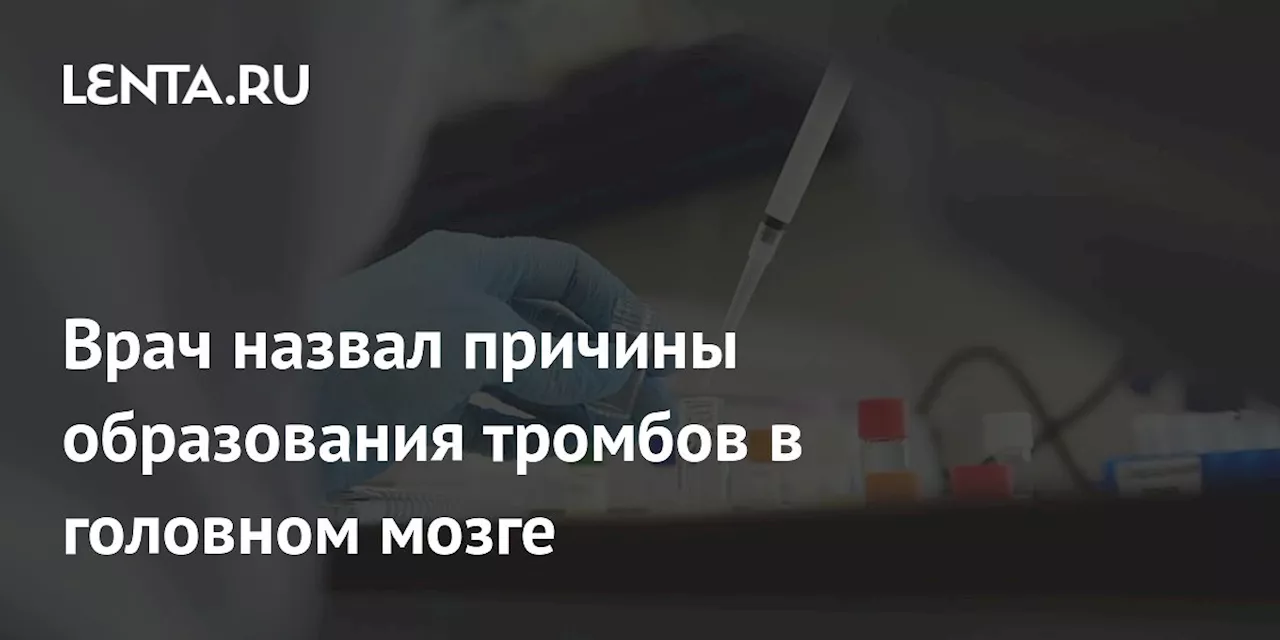 Врач назвал причины образования тромбов в головном мозге