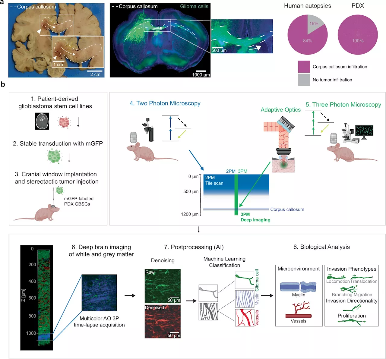 Researchers customize top-of-the-line microscopy method with AI to better understand glioblastoma tumors