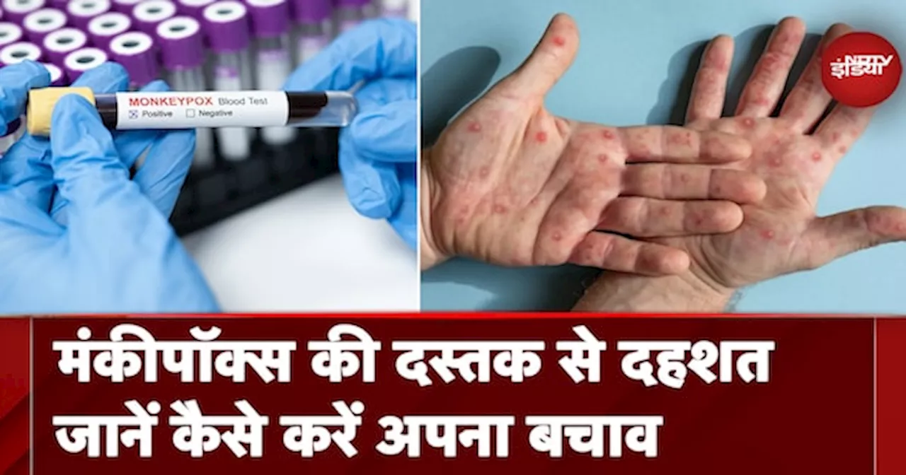 Monkey Pox Virus: भारत में मंकीपॉक्स की दस्तक से सहमे लोग, सरकार सतर्क, जान लें बचाव के तरीके