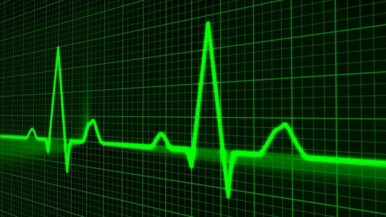 Atrial fibrillation estimated to be three times more common than previously thought