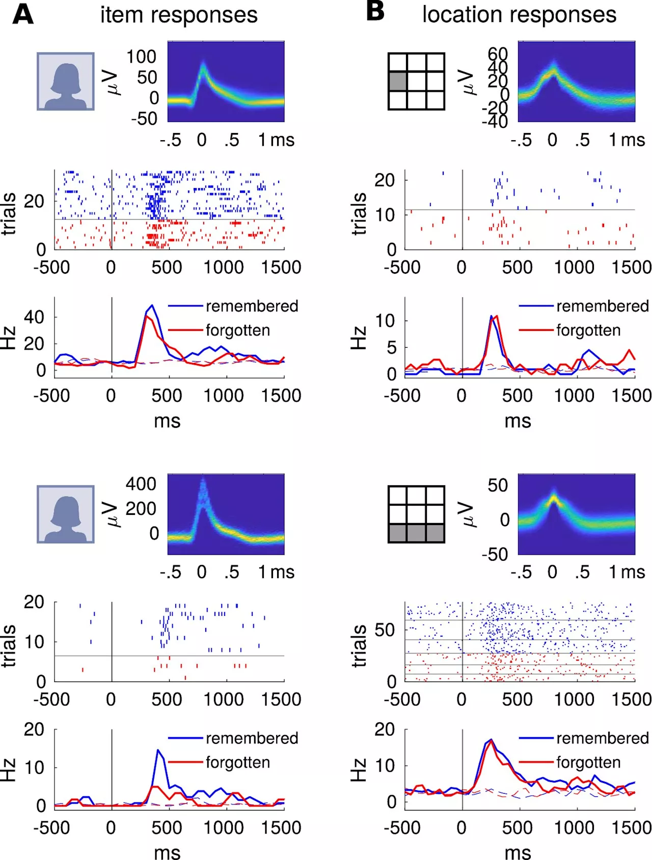 Researchers clarify the function of highly specialized nerve cells in memory