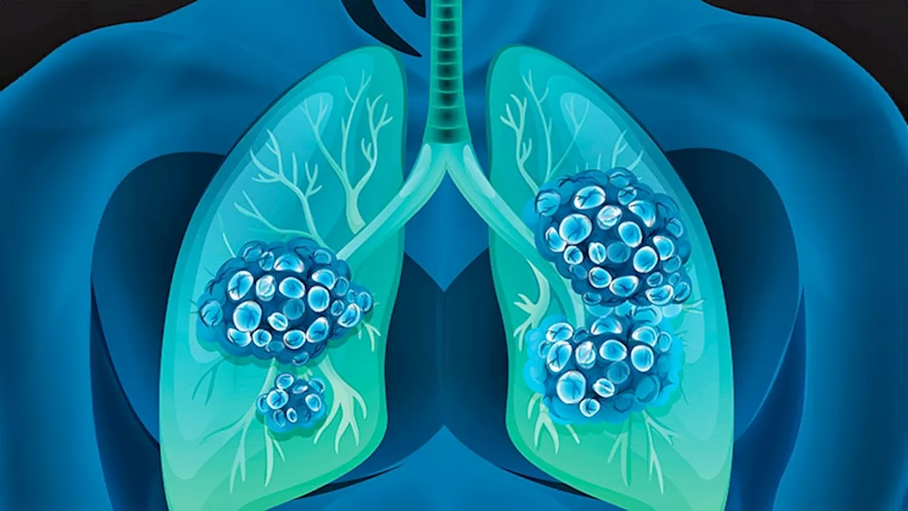 Aumolertinib Promising Maintenance Therapy in EGFR-Mutated NSCLC