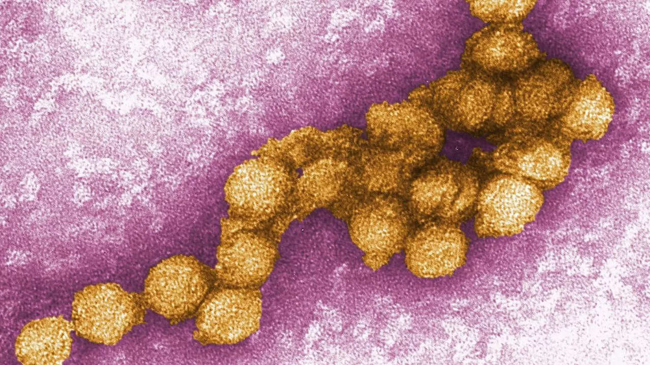 Niedersachsen & Bremen: Erster Fall von West-Nil-Virus bei Mensch in Niedersachsen