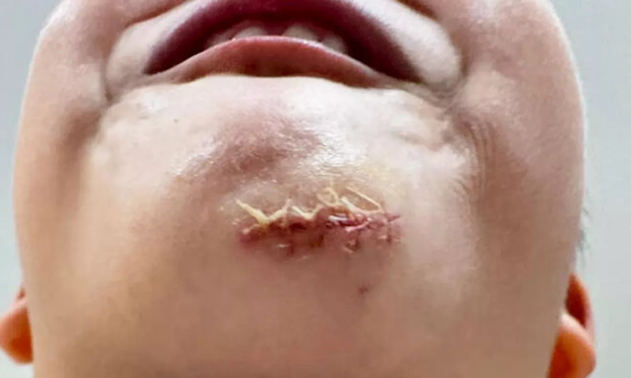Parent says Bird Paradise facilities 'not safe enough' after 6-year-old son slips and hits chin
