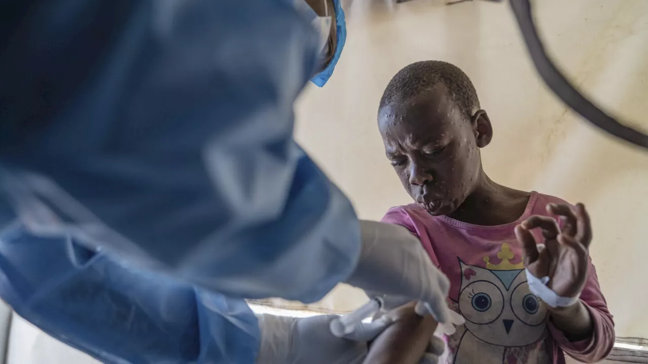 Mpox deaths rise by 107 in a week as Africa CDC calls the toll unacceptable