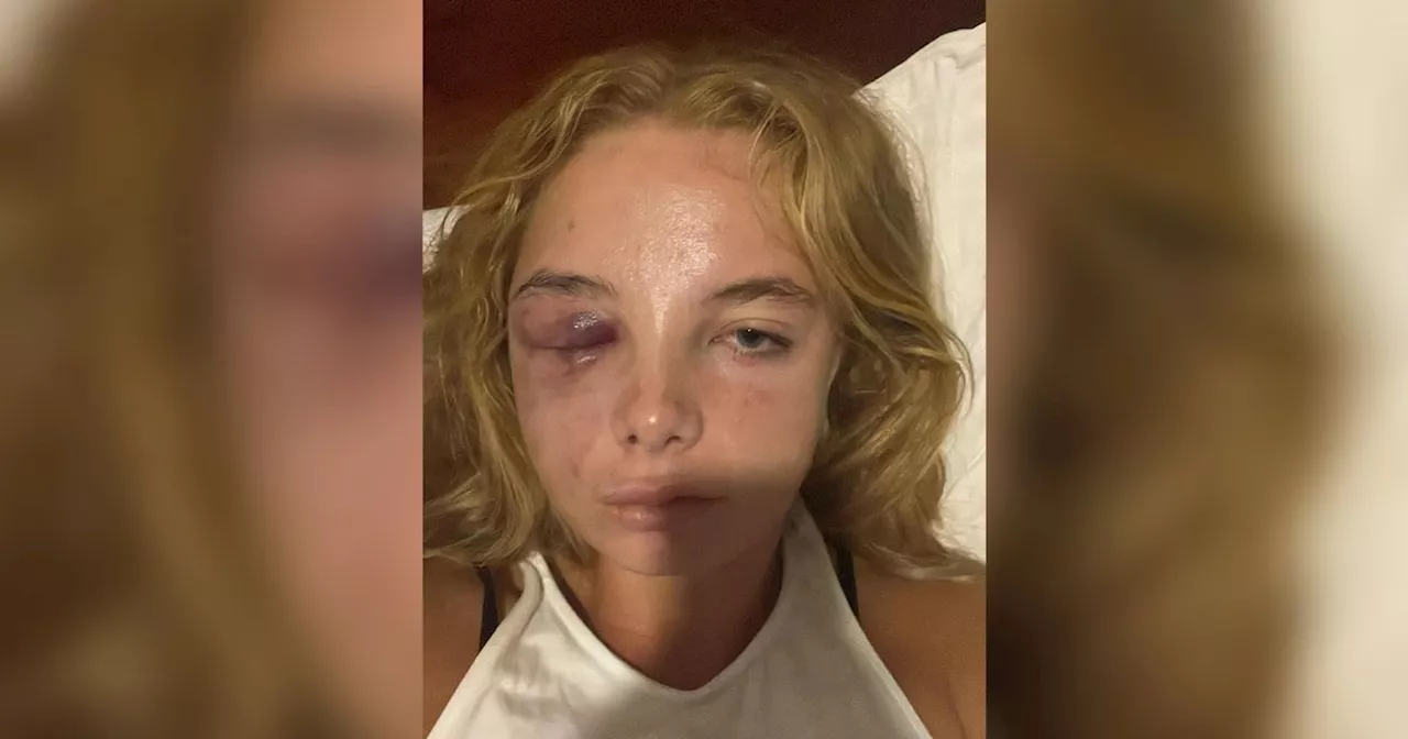 Woman 'too scared to go outside' after brutal attack in hotel room