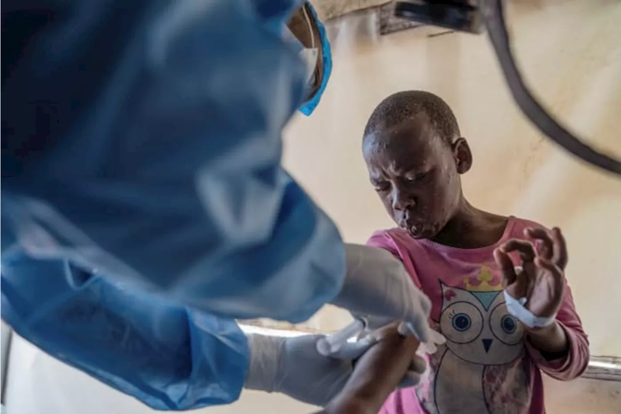 Mpox deaths rise by 107 in a week as Africa CDC calls the toll unacceptable