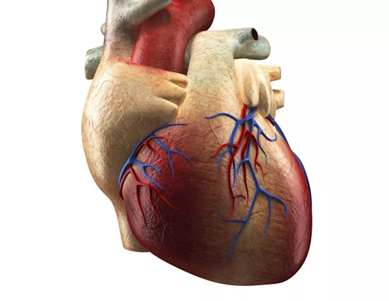 Atrial fibrillation affects more Americans than previously estimated