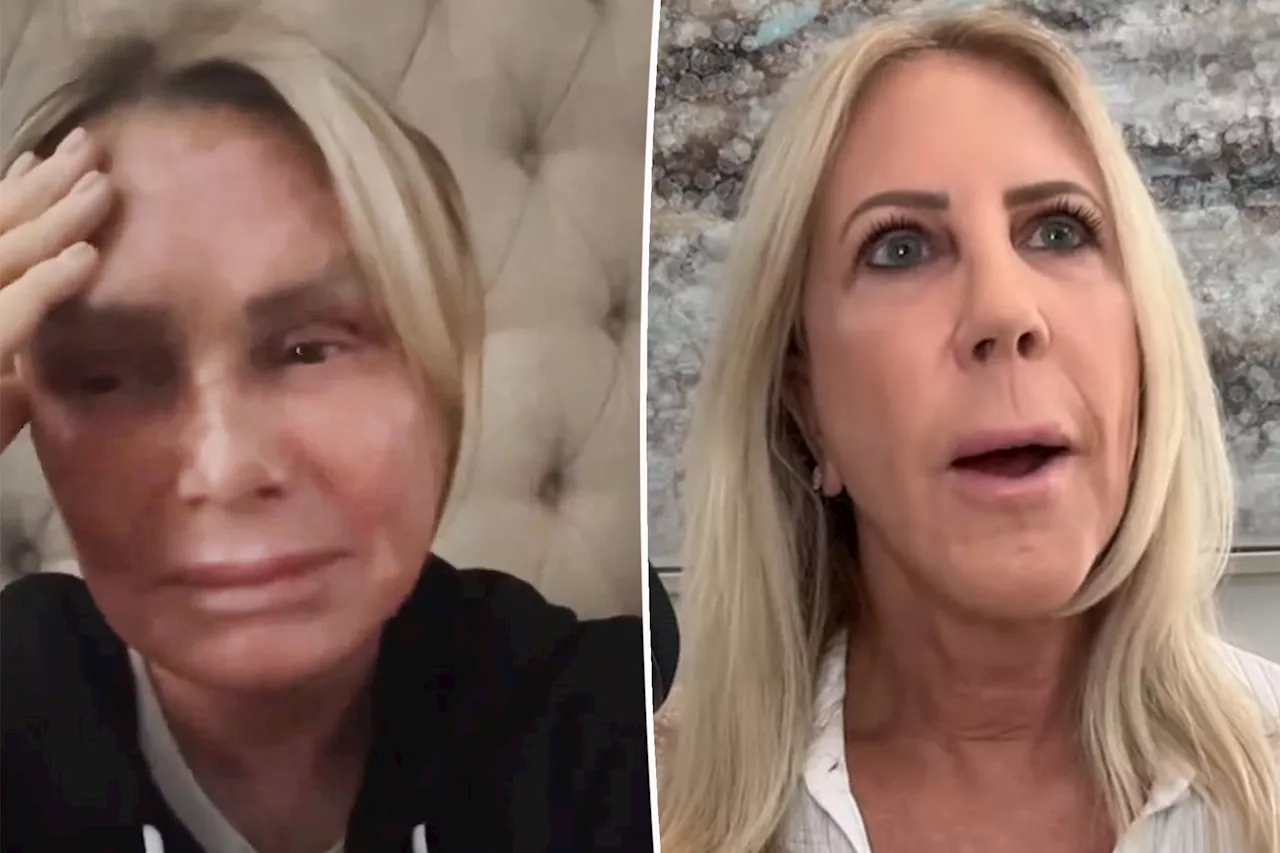 Vicki Gunvalson calls ex-friend Tamra Judge a 'good actress' after crying video: 'There were no tears'