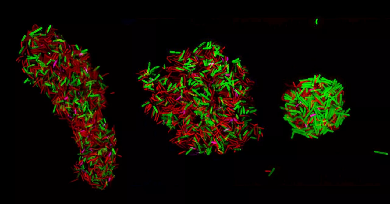 Researchers develop new technique to watch microbial populations interact