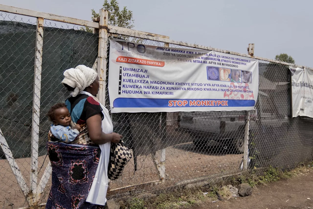 Canada to donate up to 200,000 vaccine doses to combat mpox outbreaks in Africa