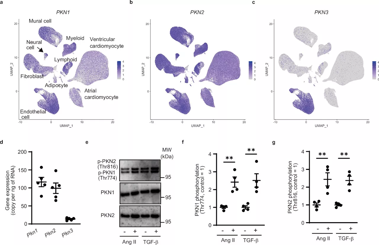 Researchers discover new target for treating heart failure: Protein kinase N