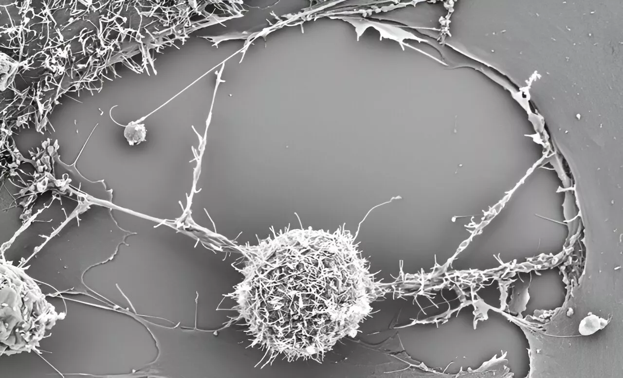 Study finds 'supercharging' T cells with mitochondria enhances their antitumor activity