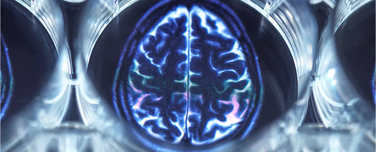 Scientists Discover a Brain Network Twice The Size in Depression Patients