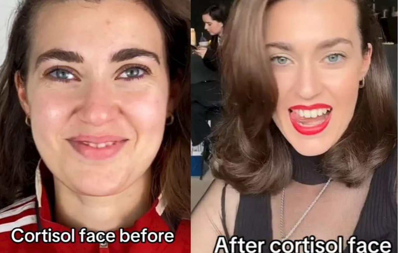 « Cortisol Face » : Est-ce que le stress fait vraiment gonfler le visage ?