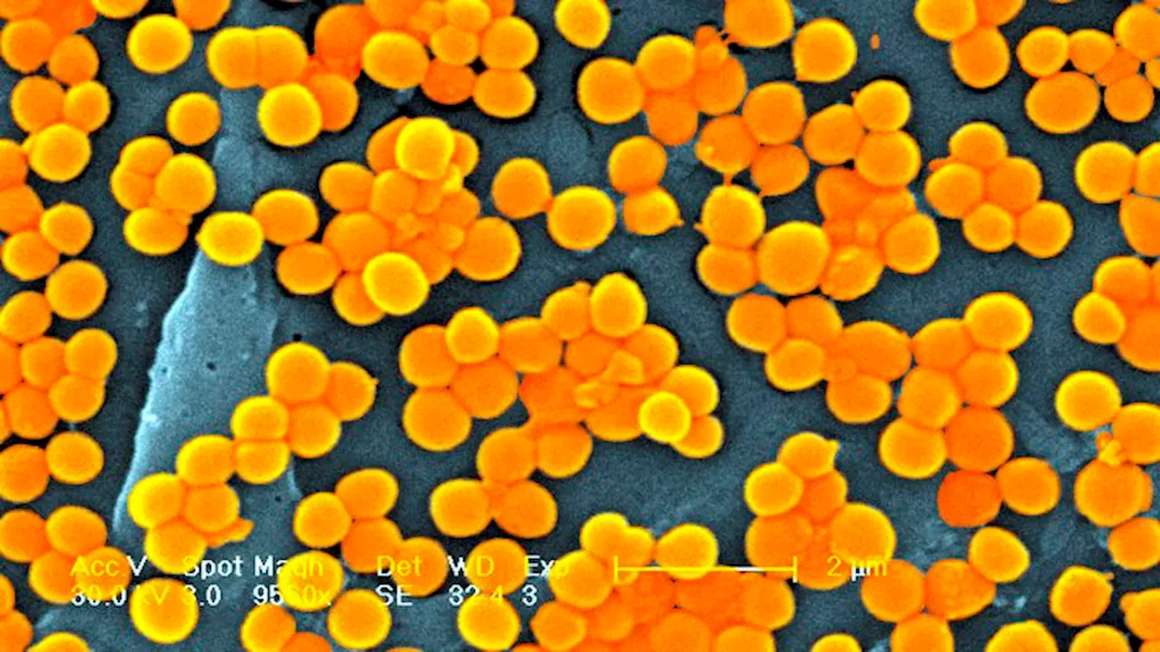 Nearly 40 million people could die from antibiotic-resistant superbug infections by 2050, new study estimates