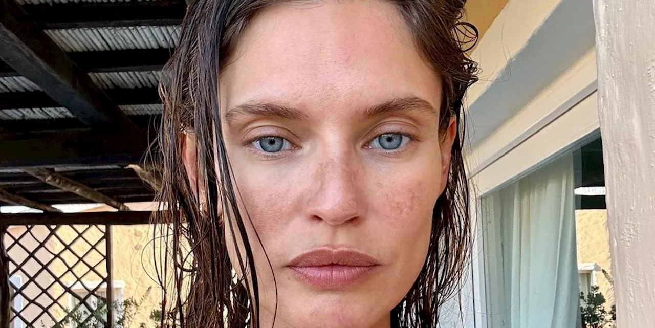 Bianca Balti racconta pubblicamente la sua battaglia contro il cancro alle ovaie