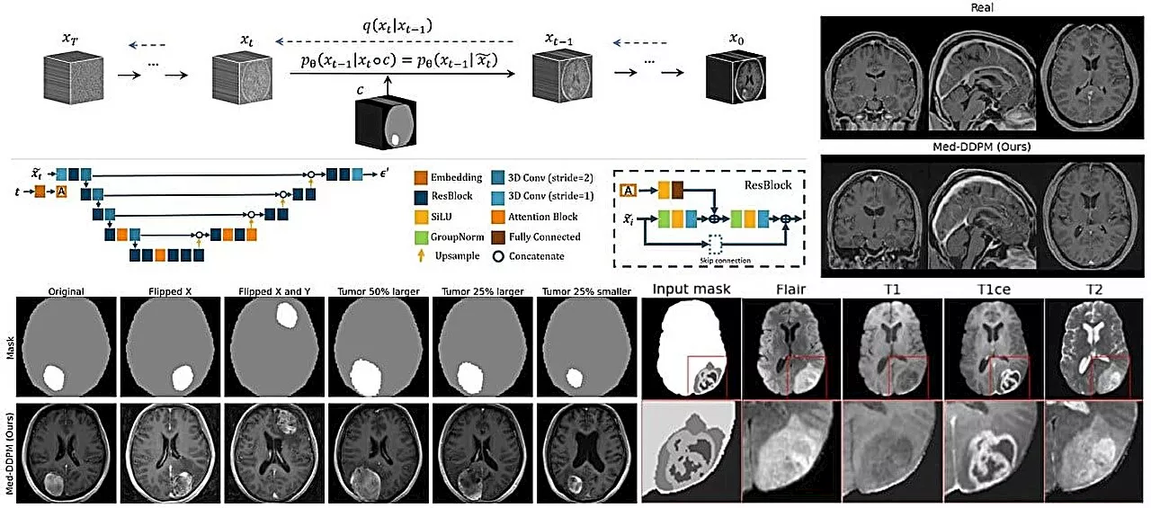 AI model can generate 3D brain MRI images while addressing data scarcity and privacy concerns