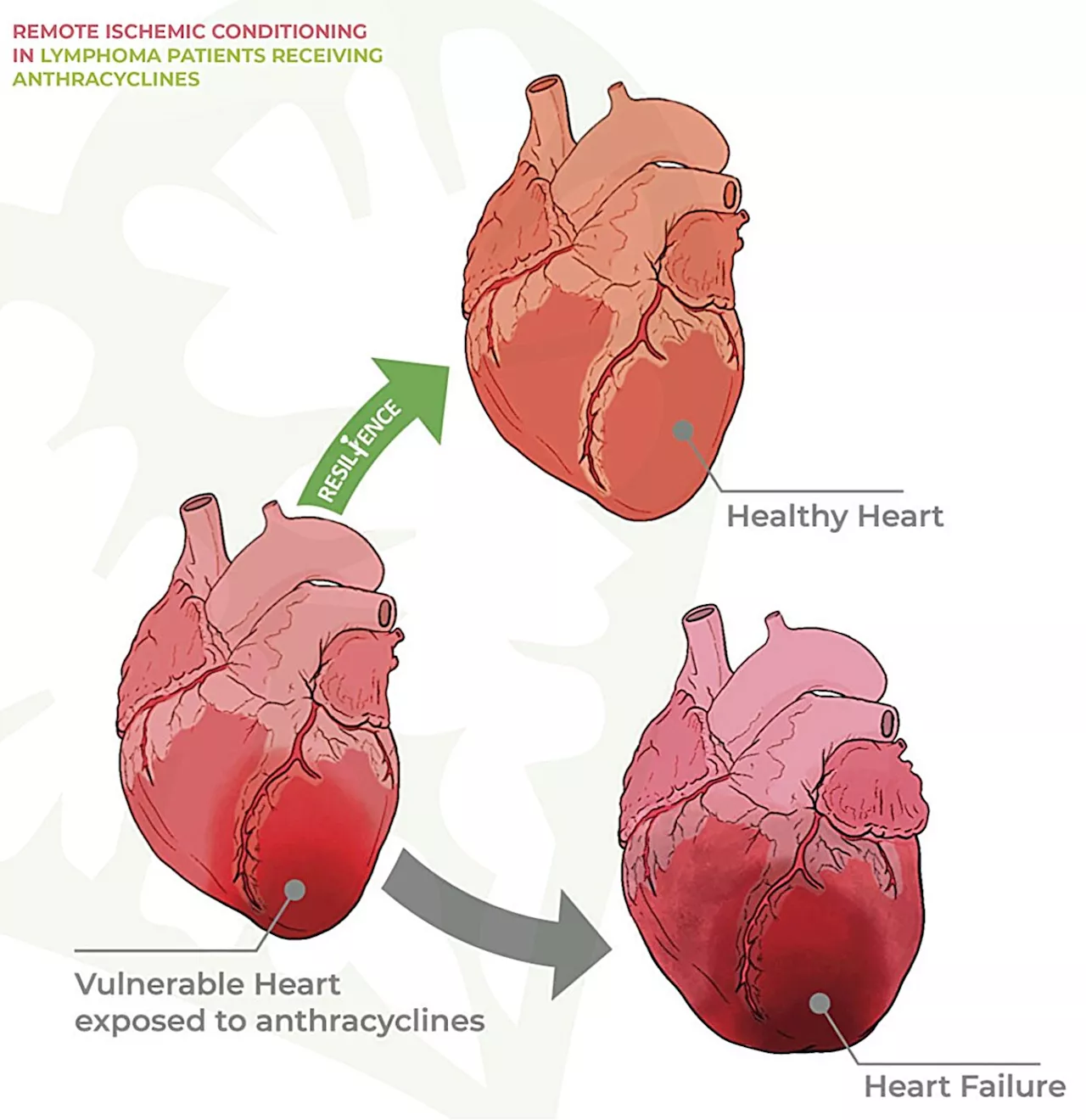 Clinical trial: Preventing heart injury caused by anticancer drugs