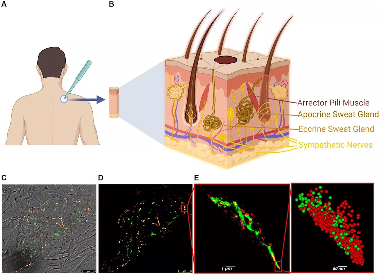 Innovative technology may enable early diagnosis of Parkinson's disease