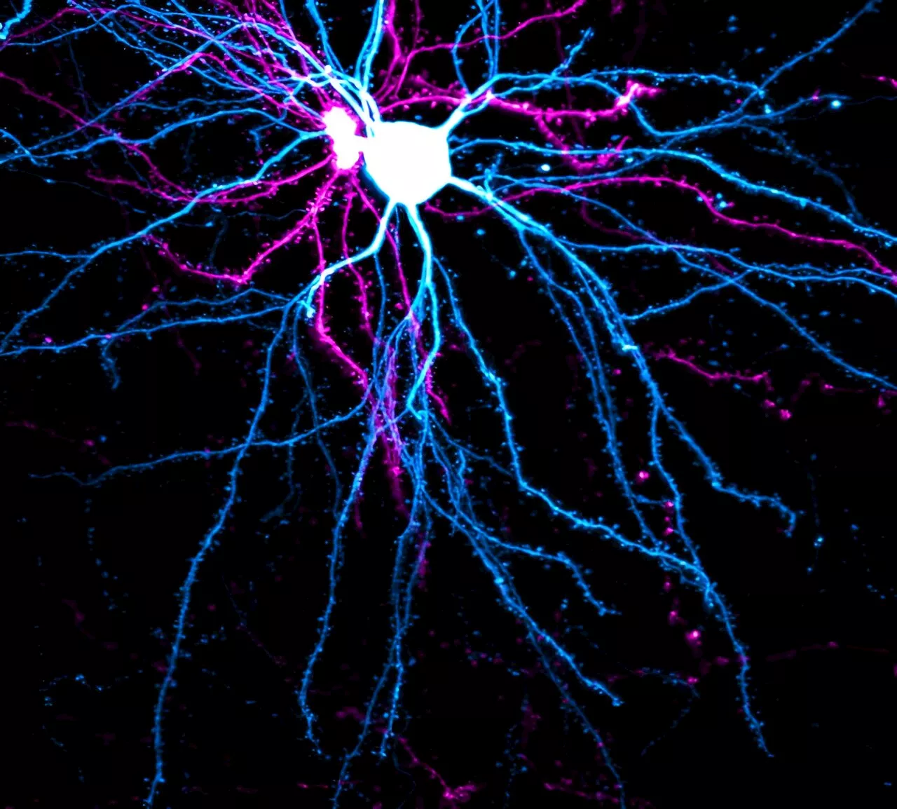 Research suggests neurons protect and preserve certain information through a dedicated zone of stable synapses