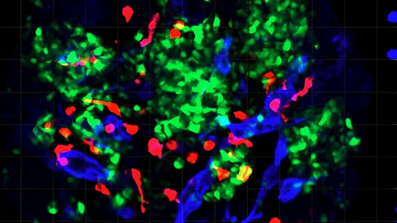 Study Reveals How COVID-19 Infection Can Cause or Worsen Diabetes