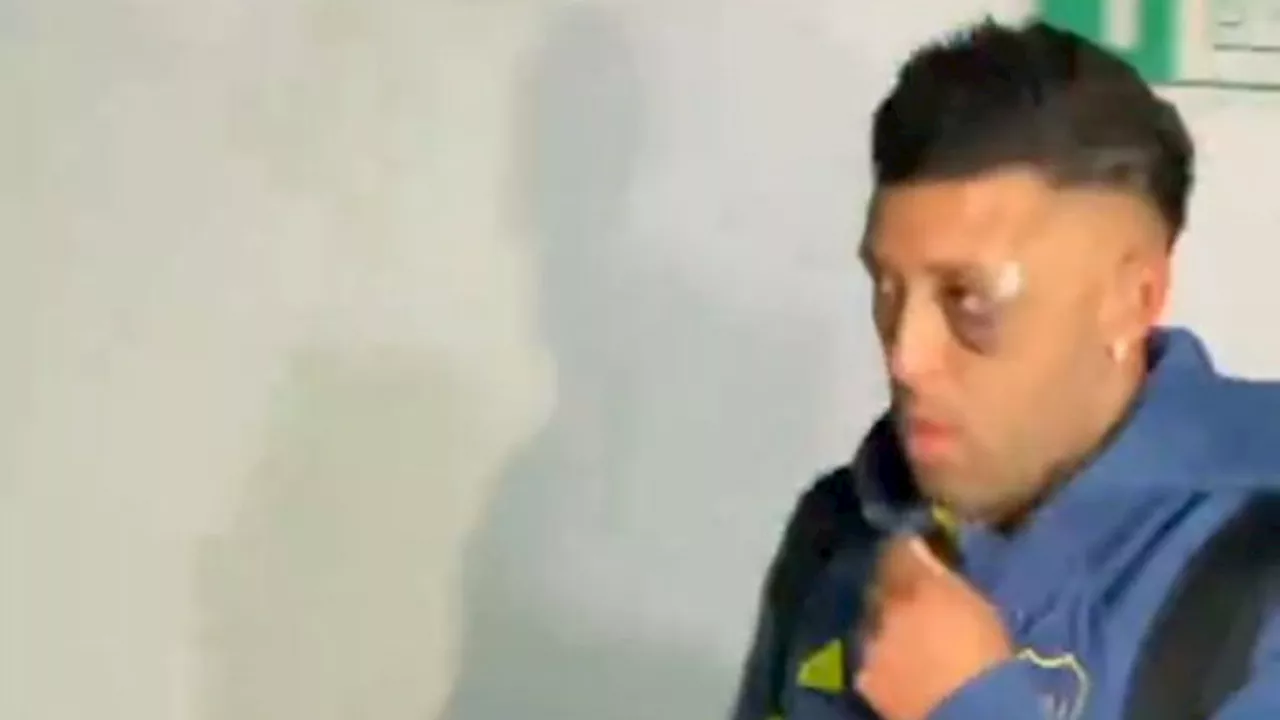 Revelan por qué Lucas Janson tenía un ojo lastimado después de la derrota de Boca con Racing
