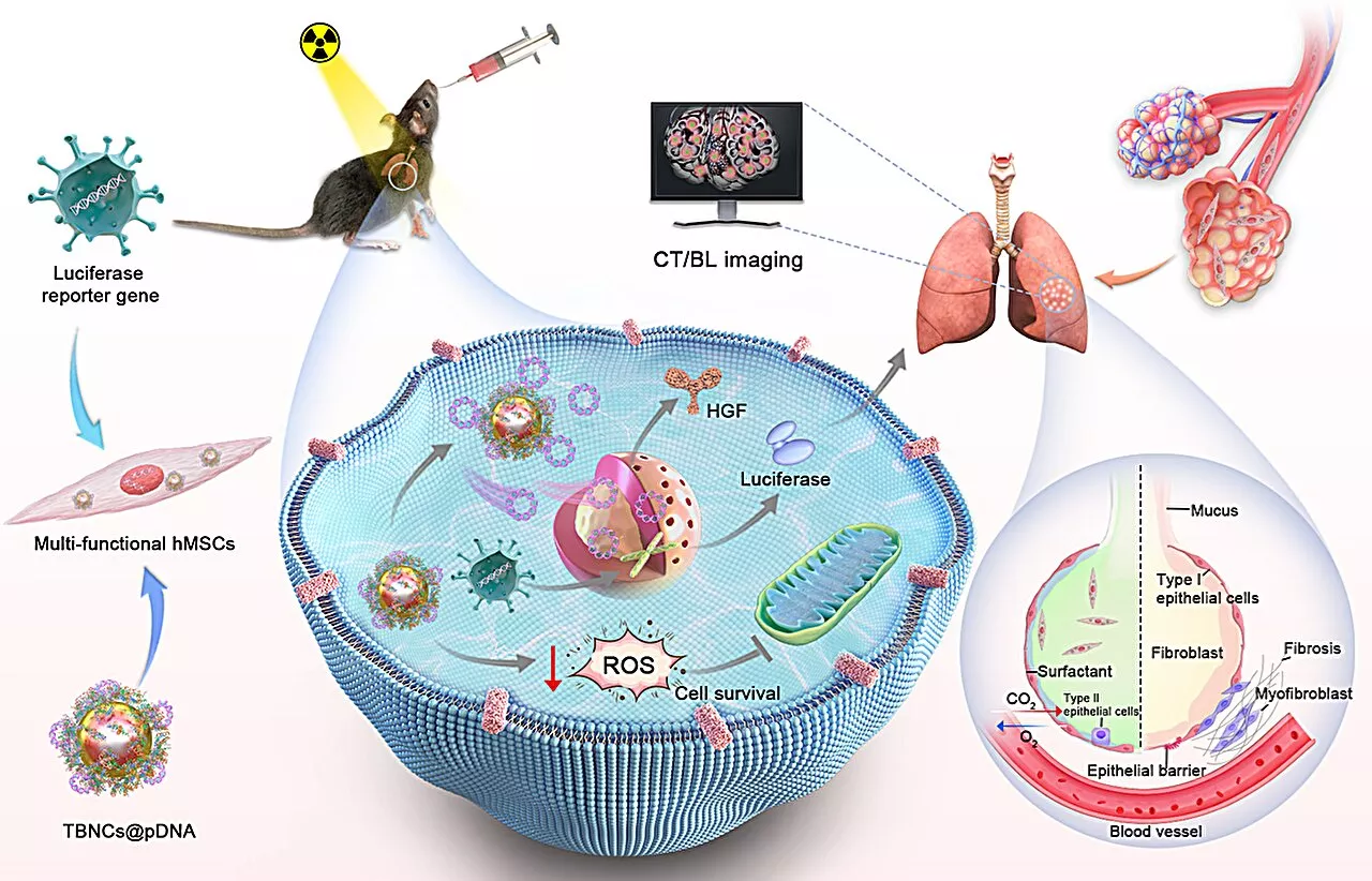 Trimetallic-based nanocarriers method shows promise for visualized idiopathic pulmonary fibrosis therapy